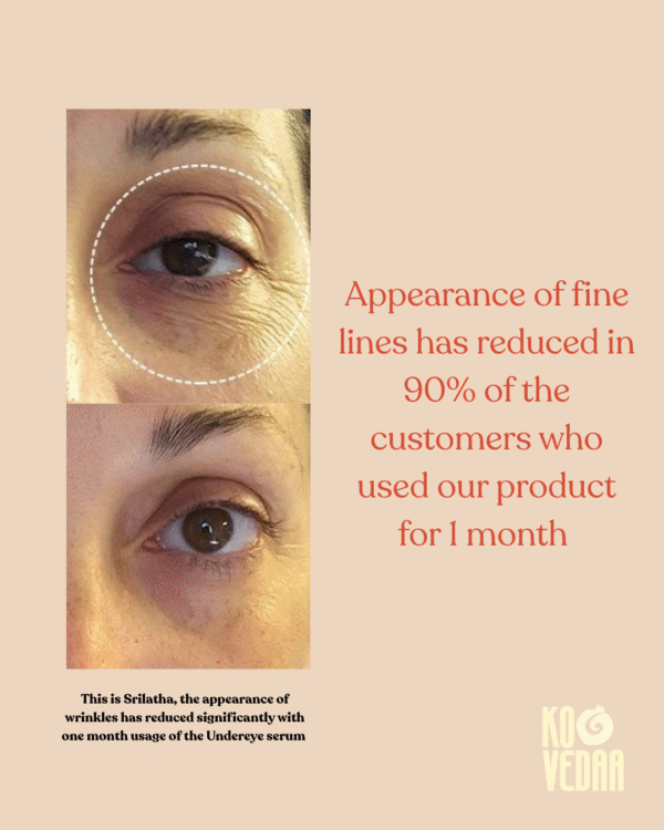 Undereye Serum - Kovedaa
